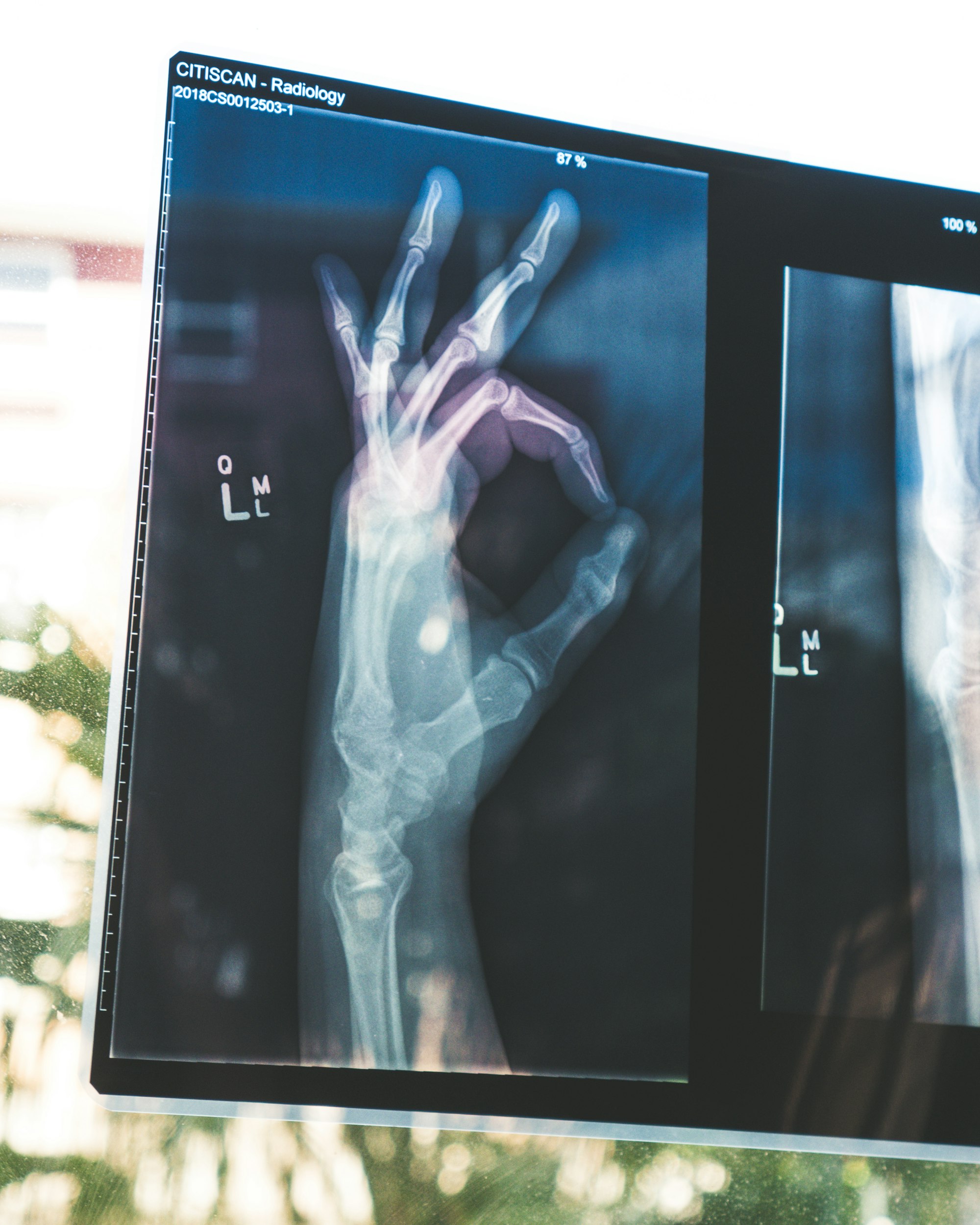 Radiology technologist reviewing an X-ray image